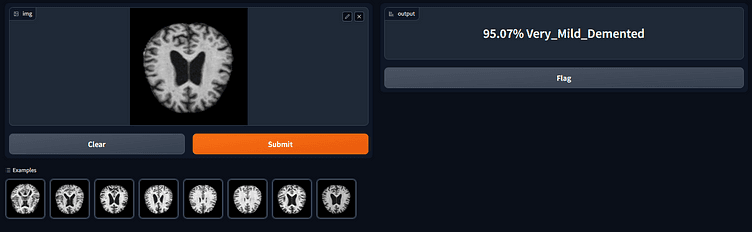Deep Learning for Dementia screenshot 1